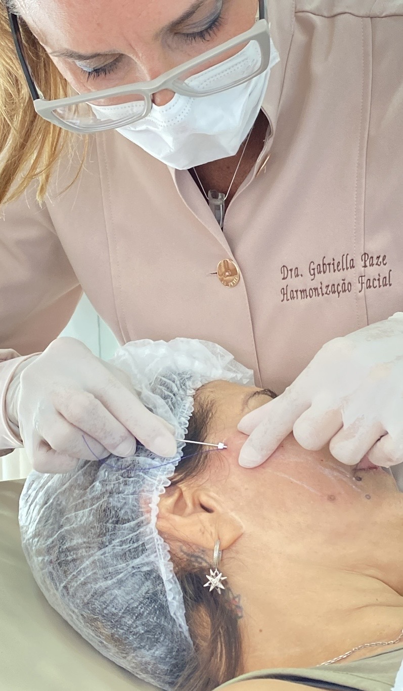 Dra. Gabriella Paze em procedimento de Harmonização Orofacial